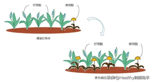 肺癌患者及家属在选择免疫治疗时,应该注意什么