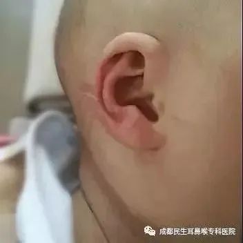 龙钞隐耳版和不隐耳