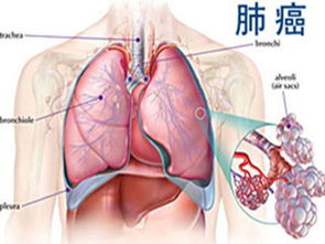 肺癌中期化疗能活多久