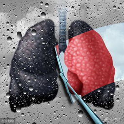 气胸和肺不张都是肺部常见病,分辨二者很重要,对治疗意义重大