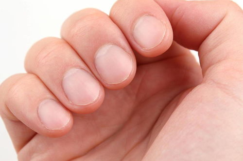 手指甲有白色月牙是什么原因