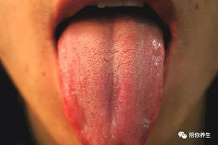 五脏六腑好不好 看舌苔就知道 最常见的舌象 你掌握了吗
