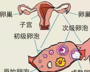 卵巢炎症的分类及相应对策