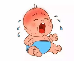 婴儿湿疹为啥保湿,湿性湿疹要保湿吗