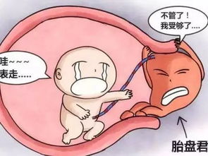 张庭做了九次人工受孕,却在怀孕时因前置胎盘只能爬行