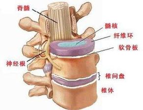 权威 腰椎间盘突出发作痛不欲生不要等需要手术 