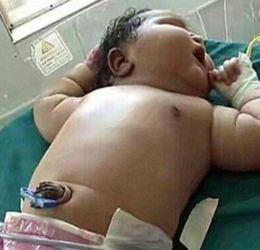 印度19岁女子产下近14斤重的巨婴,体重相当于半岁大的婴儿 