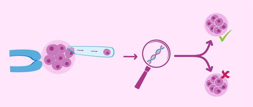 试管婴儿检查染色体的重要性
