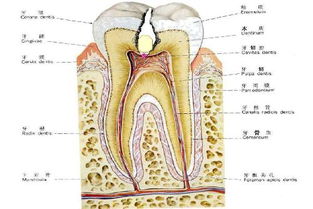 牙髓炎 牙髓炎如何根治