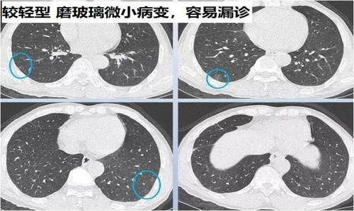 怎么分辨-图1