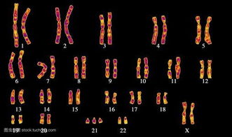 染色体正常的夫妻,为什么会出现染色体异常的胎儿