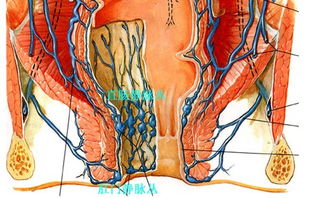 医学教授详解 痔疮产生的原理和治疗原则,弄清再治,才不走弯路