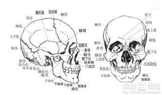 得了多发性脑梗塞要注意什么