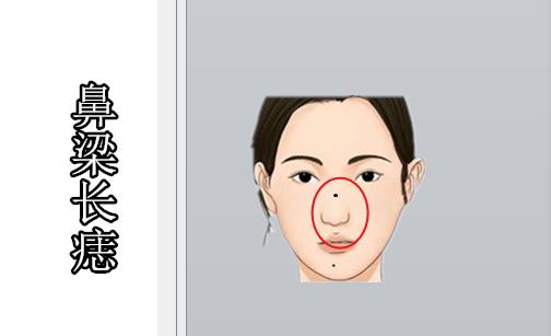 女人4颗 苦 痣,吃不好,穿不好,打一辈子工,丈夫孩子不心疼