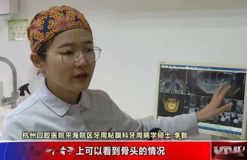 我还没找对象呢 28岁姑娘一排牙都被医生拔光 这个习惯害苦她