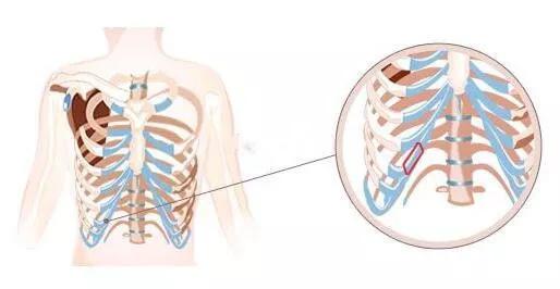 魏红军 半肋骨与全肋骨隆鼻的区别,如何选择呢