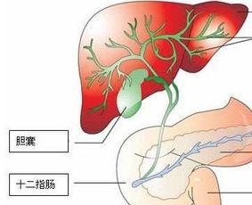 胆囊结石的治愈标准都有哪些