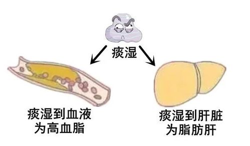 大白话说中医第一百三十期 痰湿肝火为主因,调理还需先调心