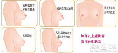 乳头溢液要做什么检查