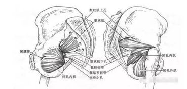 梨状肌疼痛怎样缓解,了解梨状肌疼痛