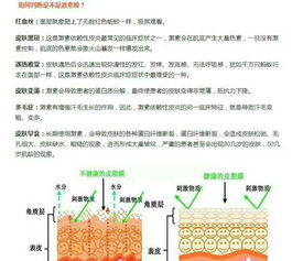 怎么判断是不是激素脸 教你轻松区别 