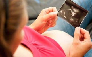 原创胎儿的出生时间晚，身体会发育得更好吗？还得看这3个条件！