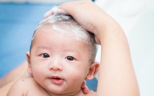 宝宝头发太少,家长别用这3种方法,不能生发反而会伤害毛囊