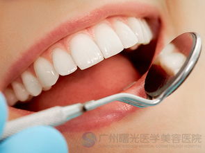 牙齿做冷光美白的优点是什么