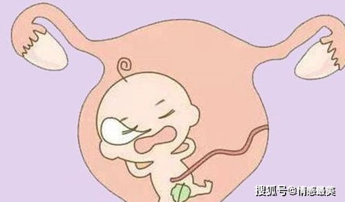 孕吐一般从什么时候开始 几个月有孕吐现象