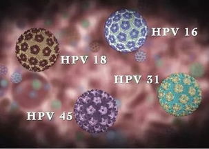 HPV阳性持续性感染的转阴方法