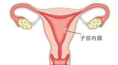 女性子宫内膜薄能不能正常怀孕 来听听医生怎么说