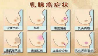 比较常见的乳腺癌的治疗方法有哪些