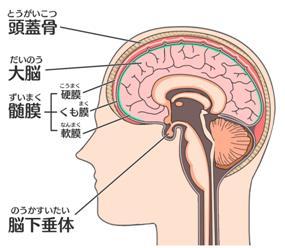 浅谈脑肿瘤的不同类型及其治疗策略