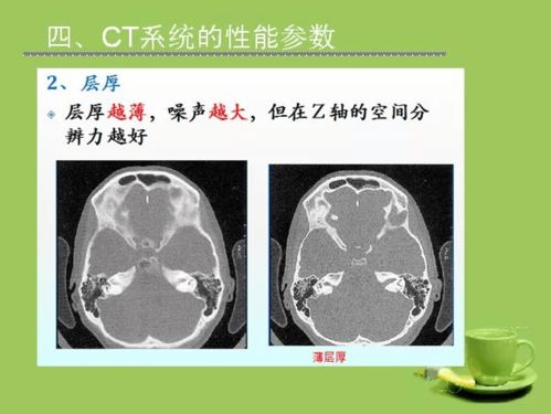 请收藏,最全CT成像原理解读