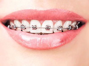 郑州哪里做牙齿正畸修复好 有牙周炎,能做牙齿正畸吗 
