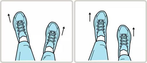 外八字脚对跑步的影响 衍生伤病治疗方法科普