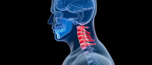 颈椎病到底有多危险 这些类型你务必要了解