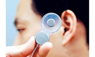 人工耳蜗30万医保能报销多少,人工耳蜗手