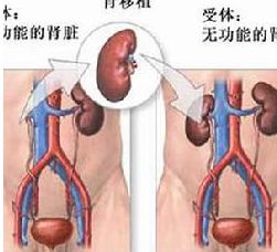 肾移植的人一般寿命活多久