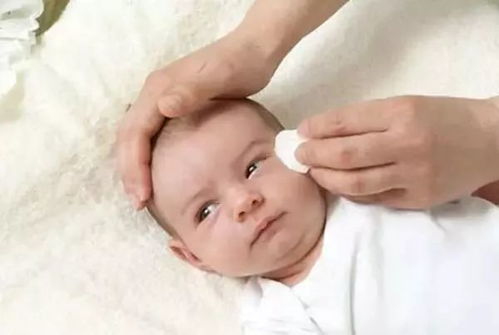 宝宝眼睛红 有眼屎,用母乳洗眼效果好 小心偏方害了娃
