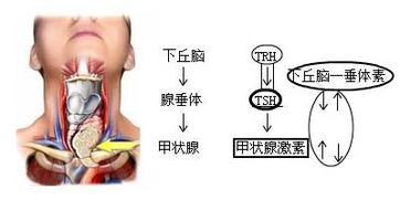 甲减是怎样造成的