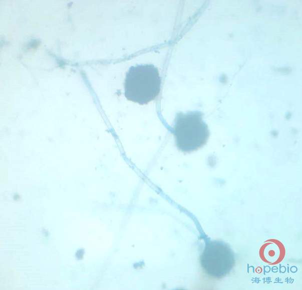 RO 3轉刺客新毒製作：化膿毒的材料Celatomx是什麼?