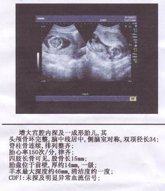 怀孕3个月胎儿b超图？三个半月B超图怎么辨男女