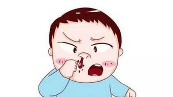 孩子流鼻血是怎么回事？孩子经常流鼻血是怎么回事呢该如何处理