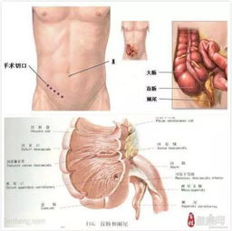 哪里病了要找 普外科 