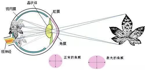 看不见的世界：眼球红外成像原理揭秘