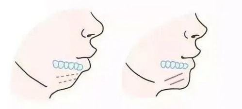 牙齿酸痛是什么原因怎么办