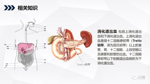 消化道出血患者护理查房