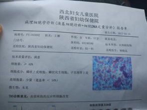 16HPV阳性还能活多久？hpv1618阳性还能活多久