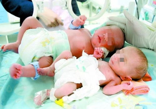 双胞胎宝宝,一个6斤重一个3斤重,宫内的 夺食大战 不得不防